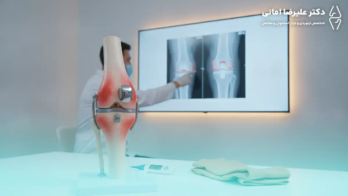 عوارض تعویض مفصل زانو؛ بررسی کامل خطرات، عوارض احتمالی و راه‌های پیشگیری