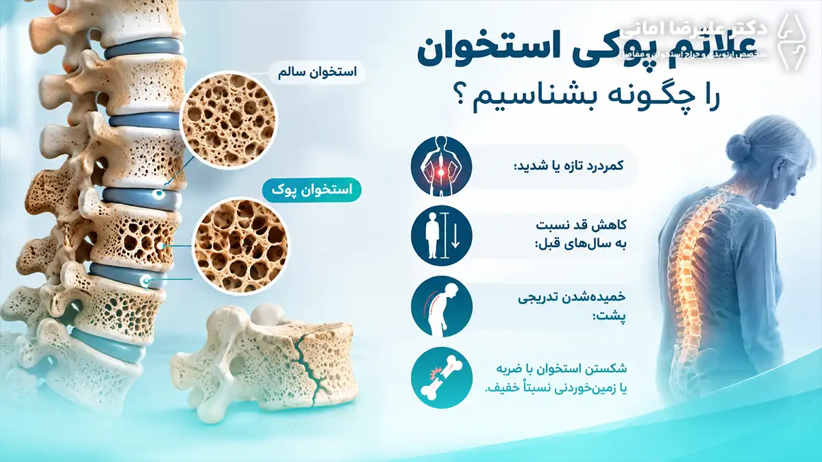 علائم پوکی استخوان را چگونه بشناسیم؟
