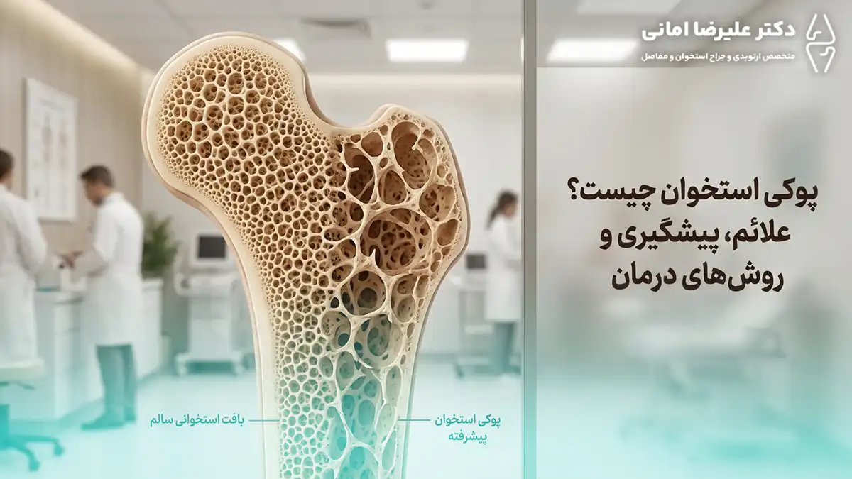 پوکی استخوان چیست؟ علائم، پیشگیری و روش‌های درمان